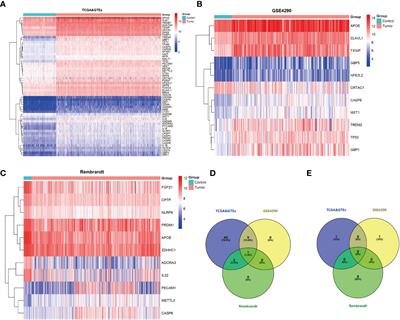 CASP6 predicts poor prognosis in glioma and correlates with tumor immune microenvironment